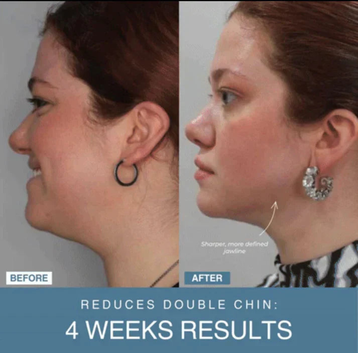 ꜰᴏʀᴀᴄᴛɪᴠᴇ™ 7-in-1 LED Anti-Aging/Wrinkle Apparatus