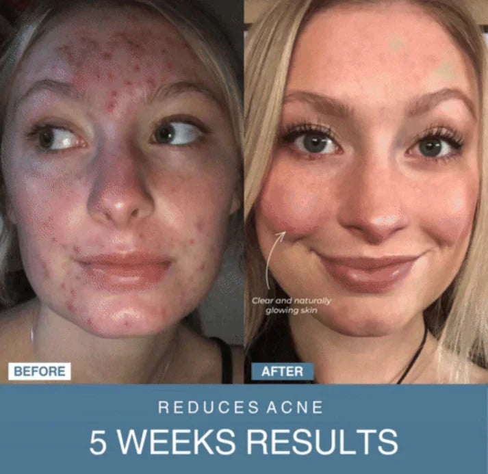 ꜰᴏʀᴀᴄᴛɪᴠᴇ™ 7-in-1 LED Anti-Aging/Wrinkle Apparatus